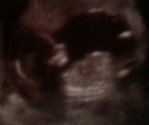 Cristina's ultrasound